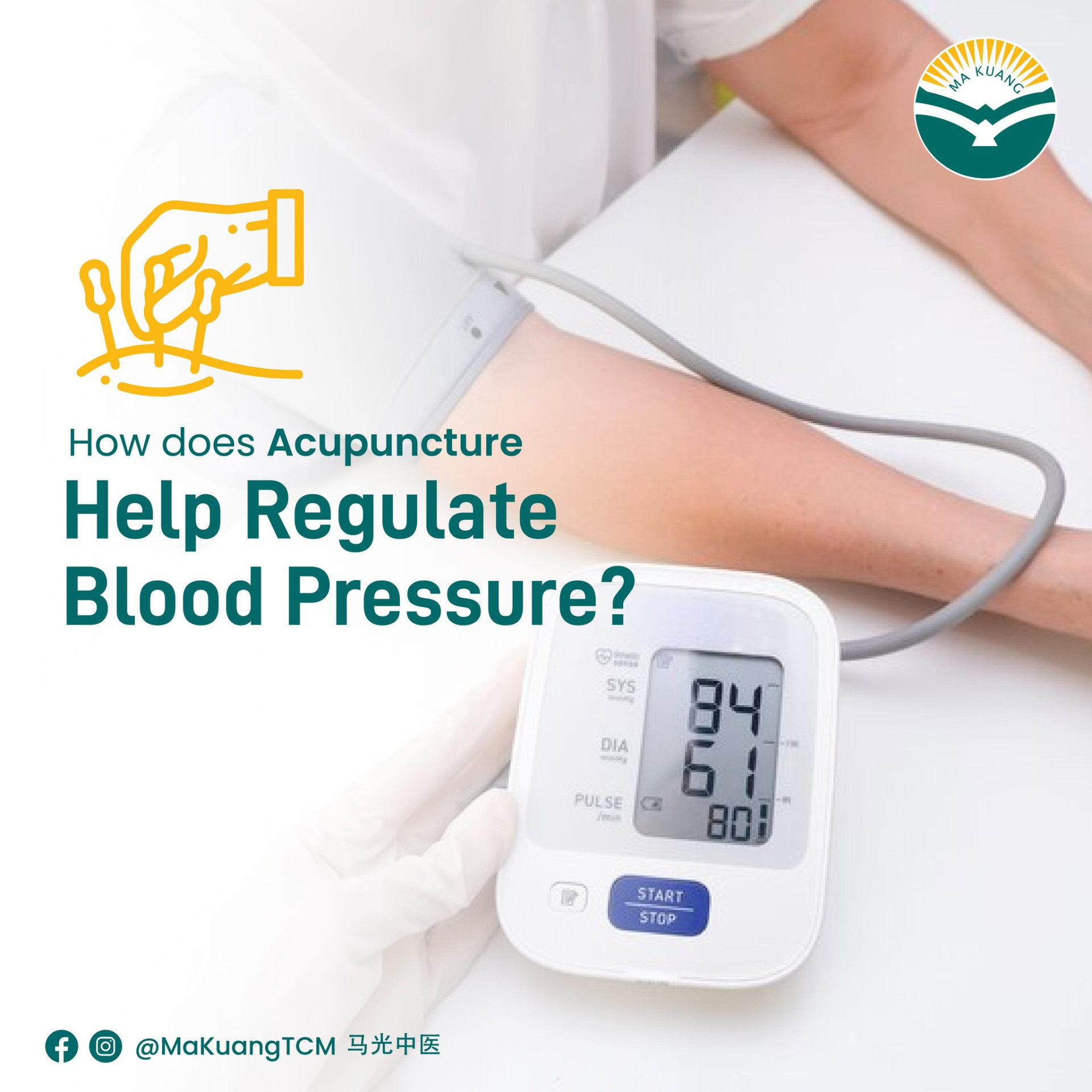 針灸如何幫助 調節血壓?